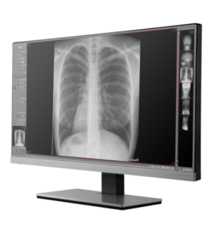 NuonHuman™ X-Ray Acquisition Software