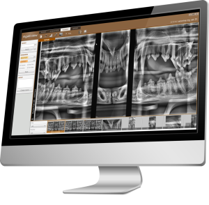 NuonVet™ X-ray Acquisition Software